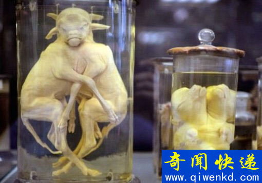 毛骨悚然!收藏畸形人遗体的尸体博物馆