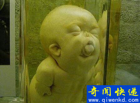 毛骨悚然!收藏畸形人遗体的尸体博物馆