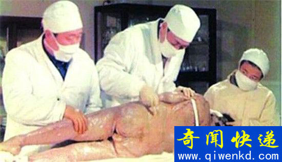 千年女尸辛追死亡真相:被香瓜子卡死