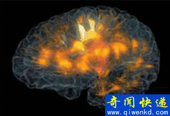 成像技术观察大脑活动 全新的体验病人的福音