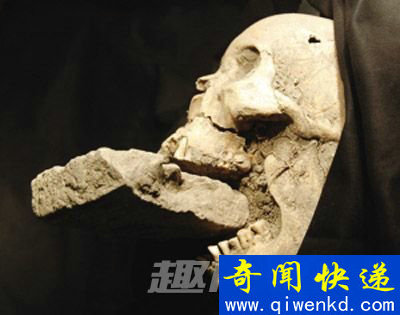“吸血鬼”女尸头骨