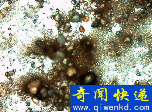 西伯利亚细菌 西伯利亚细菌