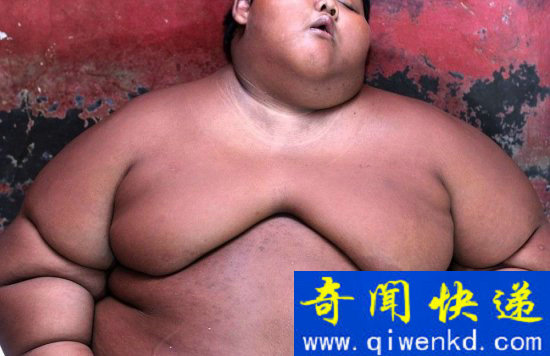 10岁胖娃成世界最重男孩 除了吃饭就是睡(3)