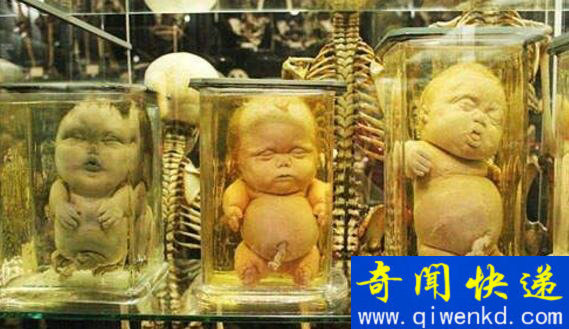 福尔马林是什么,与尸体共舞的不腐之秘(甲醛的水溶液)