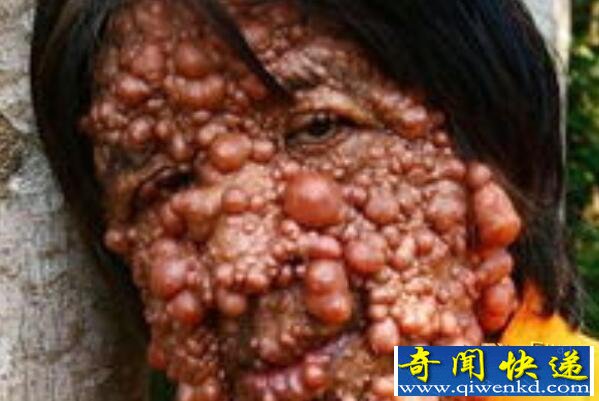 最恶心的图片