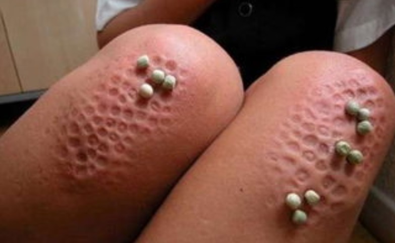 莲蓬乳和空手指是真的吗,空手指莲蓬乳恶心图片大全