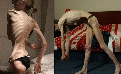 Ӣ������Ů��Ϊ��սʤ��ʳ֢ͼƬ��ʵ