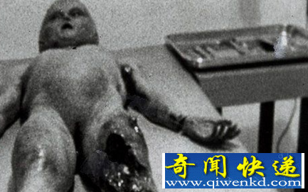 外星人尸体