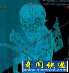 外星人婴儿模拟照片