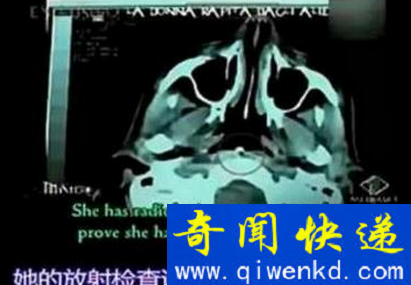 外星人婴儿