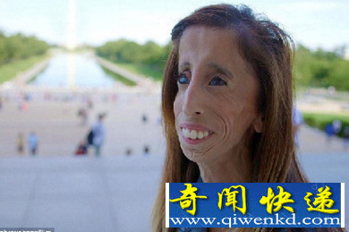世界上最丑的小女孩