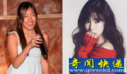 tiffany整容前后