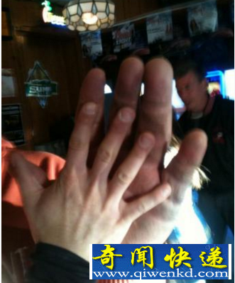 最大的手掌