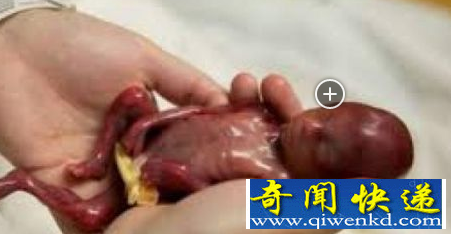 世界最小的婴儿