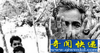 盘点世界上毒性最强的五种药物