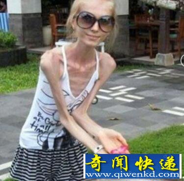 全世界最瘦女人
