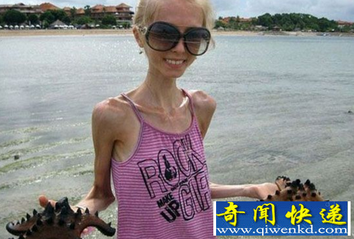 瘦到皮包骨头的女人
