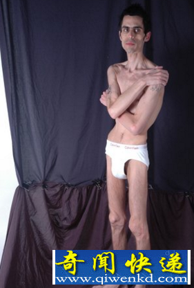 世界最瘦男人