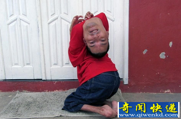 最恐怖的怪病