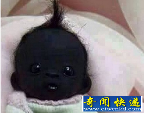世界最黑的婴儿