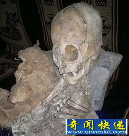 巨头干尸