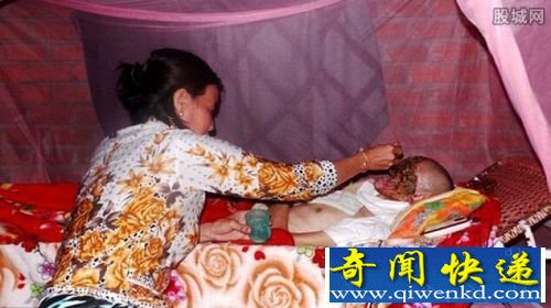 男子术后容貌尽毁