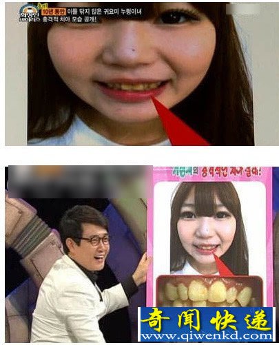 美少女十年没刷牙