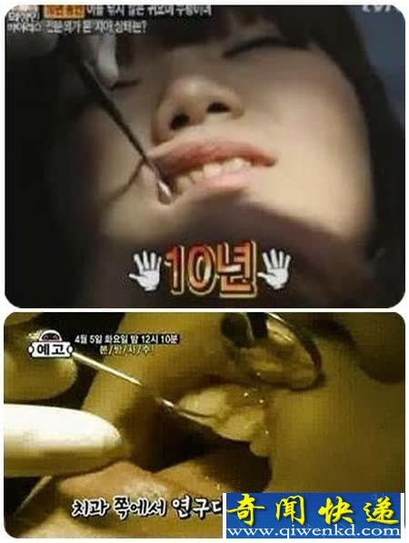 美少女十年没刷牙