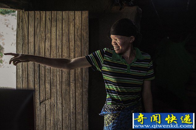 非洲的白化黑人被军警保护防止被屠杀