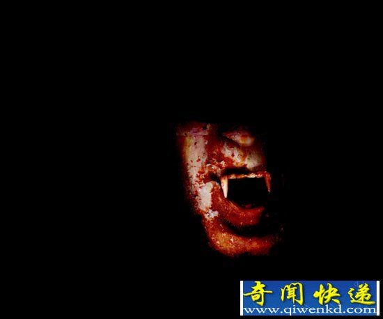 土耳其惊现现实版“吸血鬼”患者 医生称是创伤后遗症