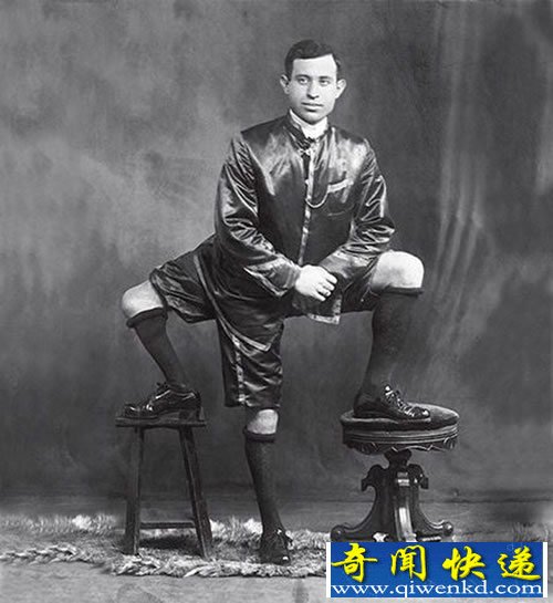 奇人 他有三条腿 还有两个功能正常的生殖器