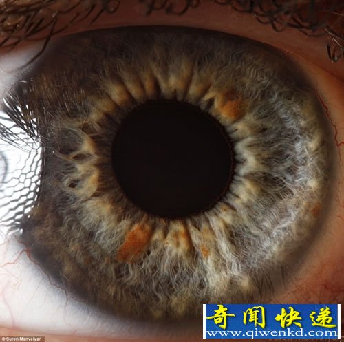 “心灵的窗户” 微距展示人眼虹膜不同寻常的细节