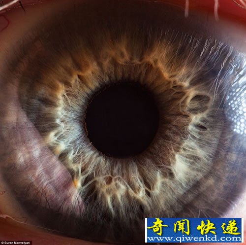 “心灵的窗户” 微距展示人眼虹膜不同寻常的细节