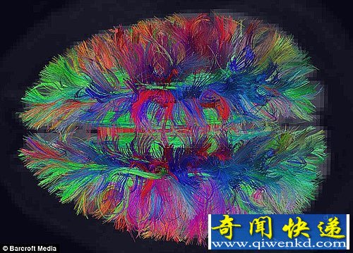 宇宙中最复杂的地形 美妙的人脑内部结构