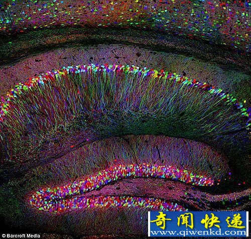 宇宙中最复杂的地形 美妙的人脑内部结构