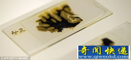 爱因斯坦大脑切片 首次在英国展出
