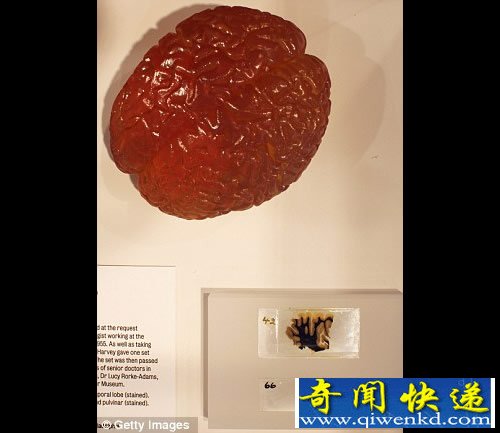 爱因斯坦大脑切片 首次在英国展出