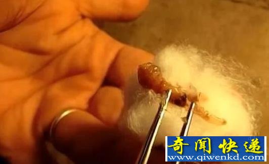 可怕!美国男子旅游归来头部留洞 罪魁祸首竟是马蝇