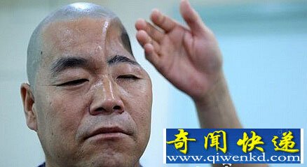 陕西男子坠楼成罕见半头人 专家拟3D技术修复其脑壳