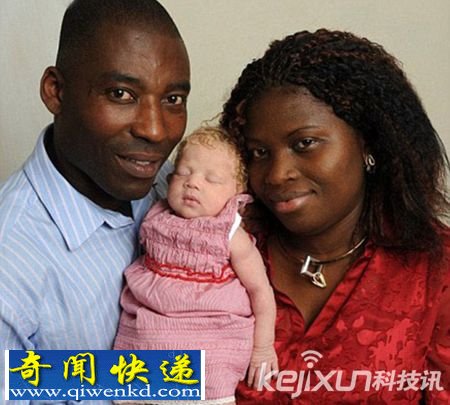 黑人妈妈诞下“纯白”婴儿 发生概率为百万分之一