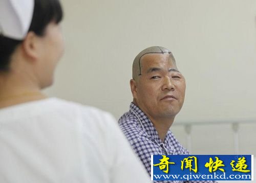 男子盖房时三楼坠落左脑盖被砸碎 通过3D打印修复脑盖