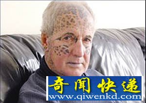 英国“豹人”“还俗”“年龄最大”的双胞胎 老太头发3.4米