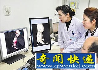 武汉孕妇怀“美人鱼宝宝” 其CT影像图曝光