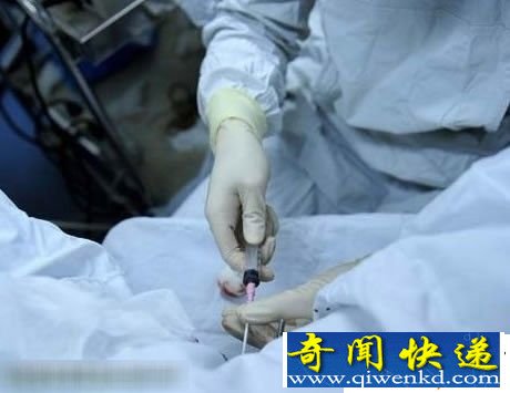组图曝光试管婴儿全过程 取卵取精手术现场