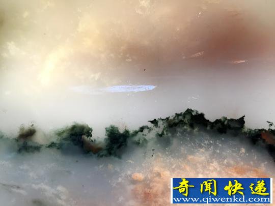 ������һ����ʯ���ھ���18���߲ʼ�Ѫ�� ר�ҹ�����3��Ԫ