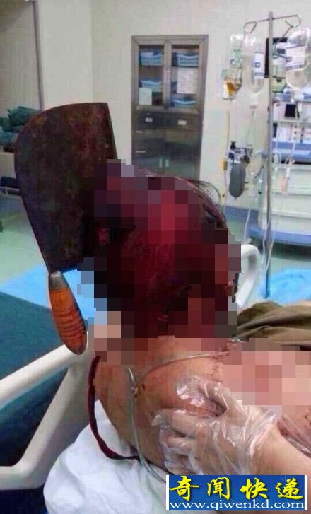 �����ò˵��������ɷ���Դ����������� Ѫ���쳣