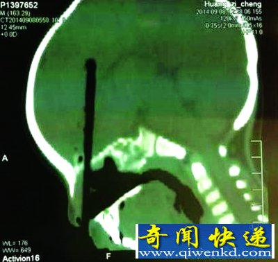 �人��ͯˤ�����Ӵӱǿײ������ ҽ����­�ο���