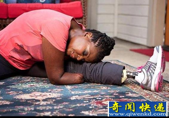 悲惨!洛杉矶女子丰臀遭遇假货 为保命截掉四肢