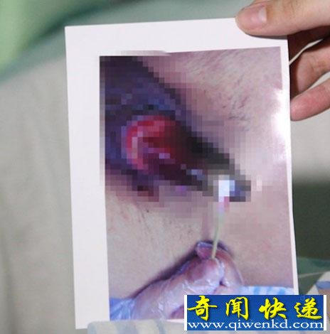 ׷��Ī����������������Ƥ�������������챻���г�