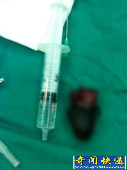 ׷��Ī����������������Ƥ�������������챻���г�